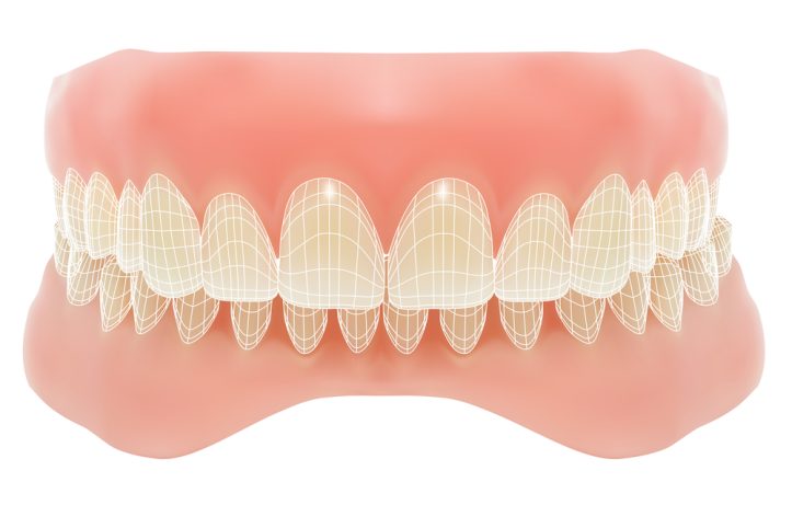 Aggravated assault addressed by Fairfax criminal lawyer- Image of jaw