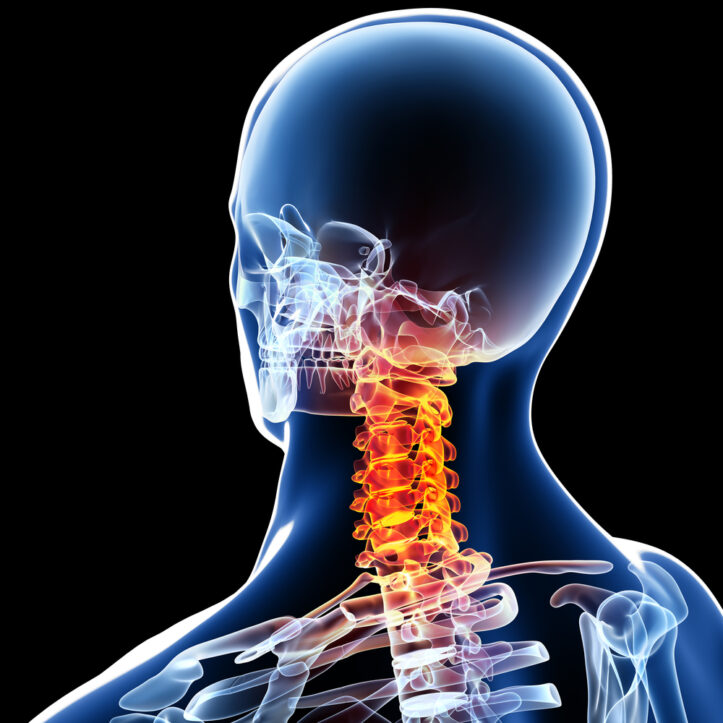 Strangulation Prosecutions In Virginia Fairfax Assault Lawyer Strangulation prosecutions in virginia fairfax assault lawyer