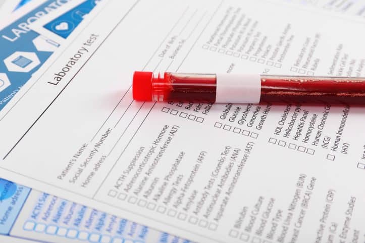 Fairfax mandatory minimum defense- Image of test tube with blood