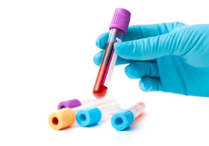 Verbally refusing- Photo of blood test tube