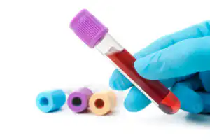 Blood tests in DWI cases according to Virginia DUI lawyer - Image of blood test tube