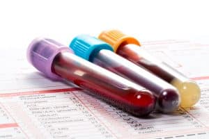 Blood testing in intoxicated driving cases - Views of Virginia DUI lawyer